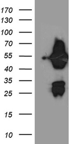 ASL Antibody in Western Blot (WB)