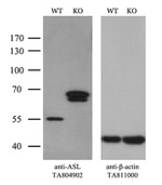ASL Antibody in Western Blot (WB)
