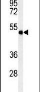 SMPDL3A Antibody in Western Blot (WB)
