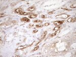 ASPDH Antibody in Immunohistochemistry (Paraffin) (IHC (P))