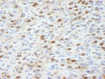 ASPP2 Antibody in Immunohistochemistry (IHC)