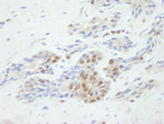 ASPP2 Antibody in Immunohistochemistry (IHC)