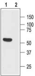 Somatostatin Receptor Type 1 (extracellular) Polyclonal Antibody