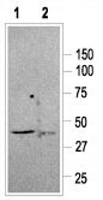 Somatostatin Receptor Type 2 Polyclonal Antibody