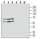 S1PR5/EDG8 (extracellular) Polyclonal Antibody