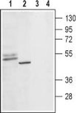 5HT1D Receptor (HTR1D) (extracellular) Polyclonal Antibody