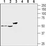 5HT2A Receptor (HTR2A) (extracellular) Antibody in Western Blot (WB)