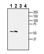 5HT2C Receptor (HTR2C) Antibody in Western Blot (WB)