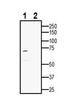 5HT2C Receptor (HTR2C) Antibody in Western Blot (WB)