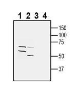 5HT6 Receptor (HTR6) (extracellular) Antibody in Western Blot (WB)