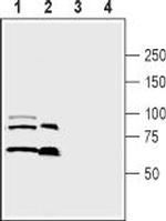 Semaphorin 3A (SEMA3A) Polyclonal Antibody