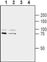 Slitrk1 (extracellular) Antibody in Western Blot (WB)