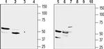 GPR91 (SUCNR1) (extracellular) Antibody in Western Blot (WB)