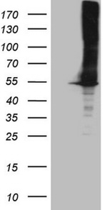 ASS1 Antibody in Western Blot (WB)