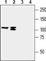 SVCT2/SLC23A2 (extracellular) Antibody in Western Blot (WB)
