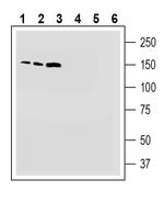 TMC1 (extracellular) Polyclonal Antibody
