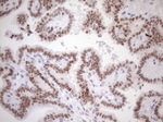 ATF1 Antibody in Immunohistochemistry (Paraffin) (IHC (P))