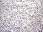 ATF1 Antibody in Immunohistochemistry (Paraffin) (IHC (P))