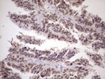 ATF1 Antibody in Immunohistochemistry (Paraffin) (IHC (P))