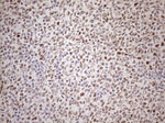 ATF1 Antibody in Immunohistochemistry (Paraffin) (IHC (P))