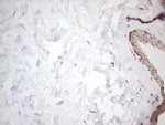ATF1 Antibody in Immunohistochemistry (Paraffin) (IHC (P))