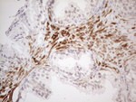 ATF1 Antibody in Immunohistochemistry (Paraffin) (IHC (P))