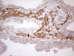 ATF1 Antibody in Immunohistochemistry (Paraffin) (IHC (P))