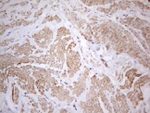 ATF1 Antibody in Immunohistochemistry (Paraffin) (IHC (P))