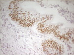 ATF1 Antibody in Immunohistochemistry (Paraffin) (IHC (P))