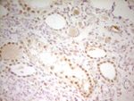 ATF1 Antibody in Immunohistochemistry (Paraffin) (IHC (P))