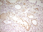 ATF1 Antibody in Immunohistochemistry (Paraffin) (IHC (P))