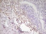 ATF1 Antibody in Immunohistochemistry (Paraffin) (IHC (P))