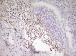 ATF1 Antibody in Immunohistochemistry (Paraffin) (IHC (P))