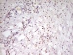 ATF1 Antibody in Immunohistochemistry (Paraffin) (IHC (P))