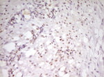 ATF1 Antibody in Immunohistochemistry (Paraffin) (IHC (P))