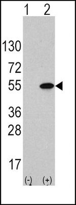 ATF4 Antibody in Western Blot (WB)