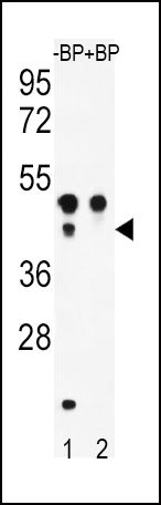 ATF4 Antibody in Western Blot (WB)