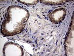 ATG16L1 Antibody in Immunohistochemistry (Paraffin) (IHC (P))