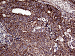 ATG4B Antibody in Immunohistochemistry (Paraffin) (IHC (P))