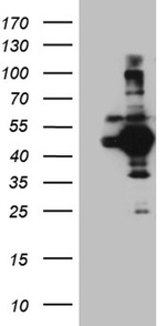 ATG4B Antibody in Western Blot (WB)
