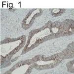 ATIC Monoclonal Antibody (F38 P7 H9)