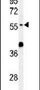 ATL3 Antibody in Western Blot (WB)