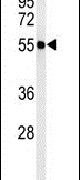 ATL3 Antibody in Western Blot (WB)