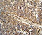 ATP13A3 Antibody in Immunohistochemistry (IHC)