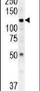 ATP13A3 Antibody in Western Blot (WB)