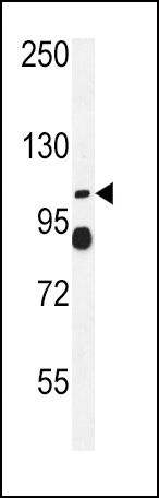 ATP1A2 Antibody in Western Blot (WB)