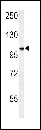 ATP1A2 Antibody in Western Blot (WB)