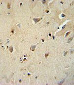 ATP1B1 Antibody in Immunohistochemistry (IHC)