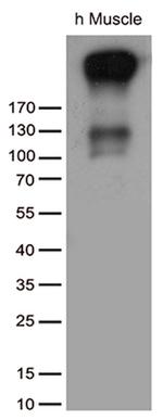 ATP2A2 Antibody in Western Blot (WB)