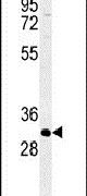 ATP4B Antibody in Western Blot (WB)